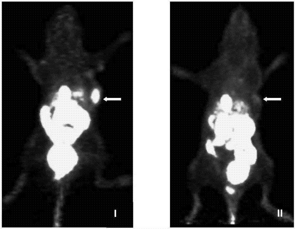 GPC3 receptor targeted polypeptide radioactive diagnosis or therapeutic drug