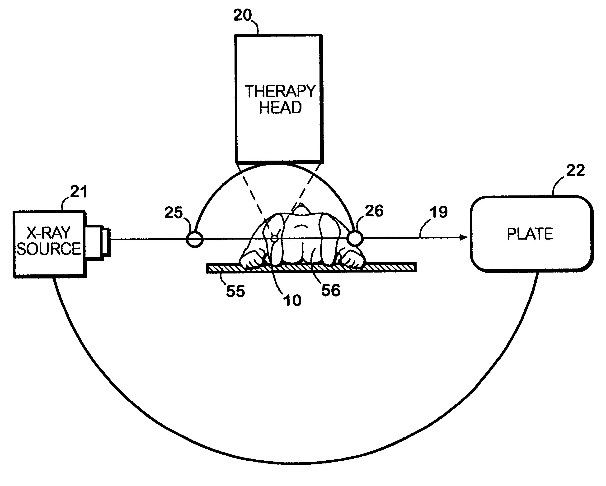 Method for using acoustic shock waves in the treatment of medical conditions