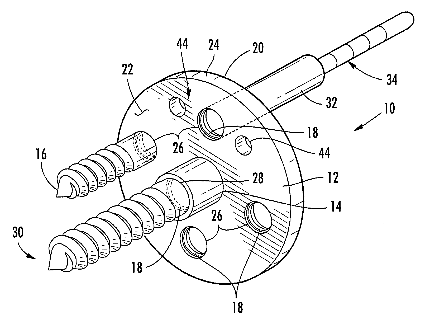 Base plate system for shoulder arthroplasty and method of using the same