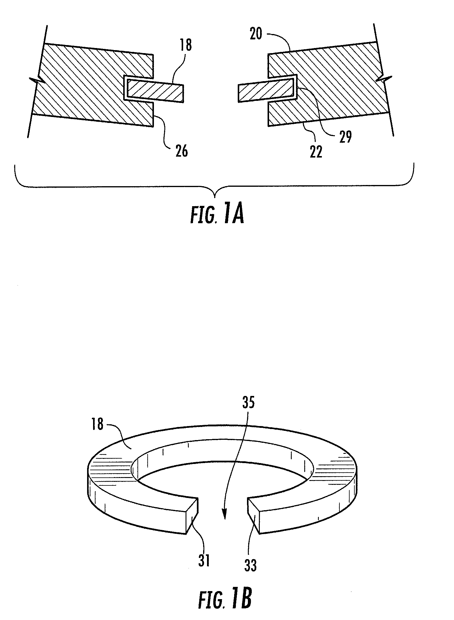 Base plate system for shoulder arthroplasty and method of using the same