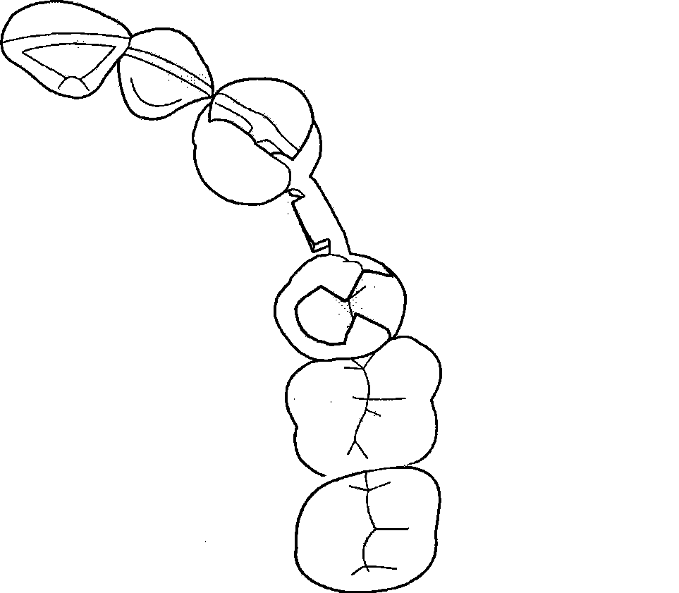 Split tooth prosthesis for fixing and repairing deficient toot and production method thereof