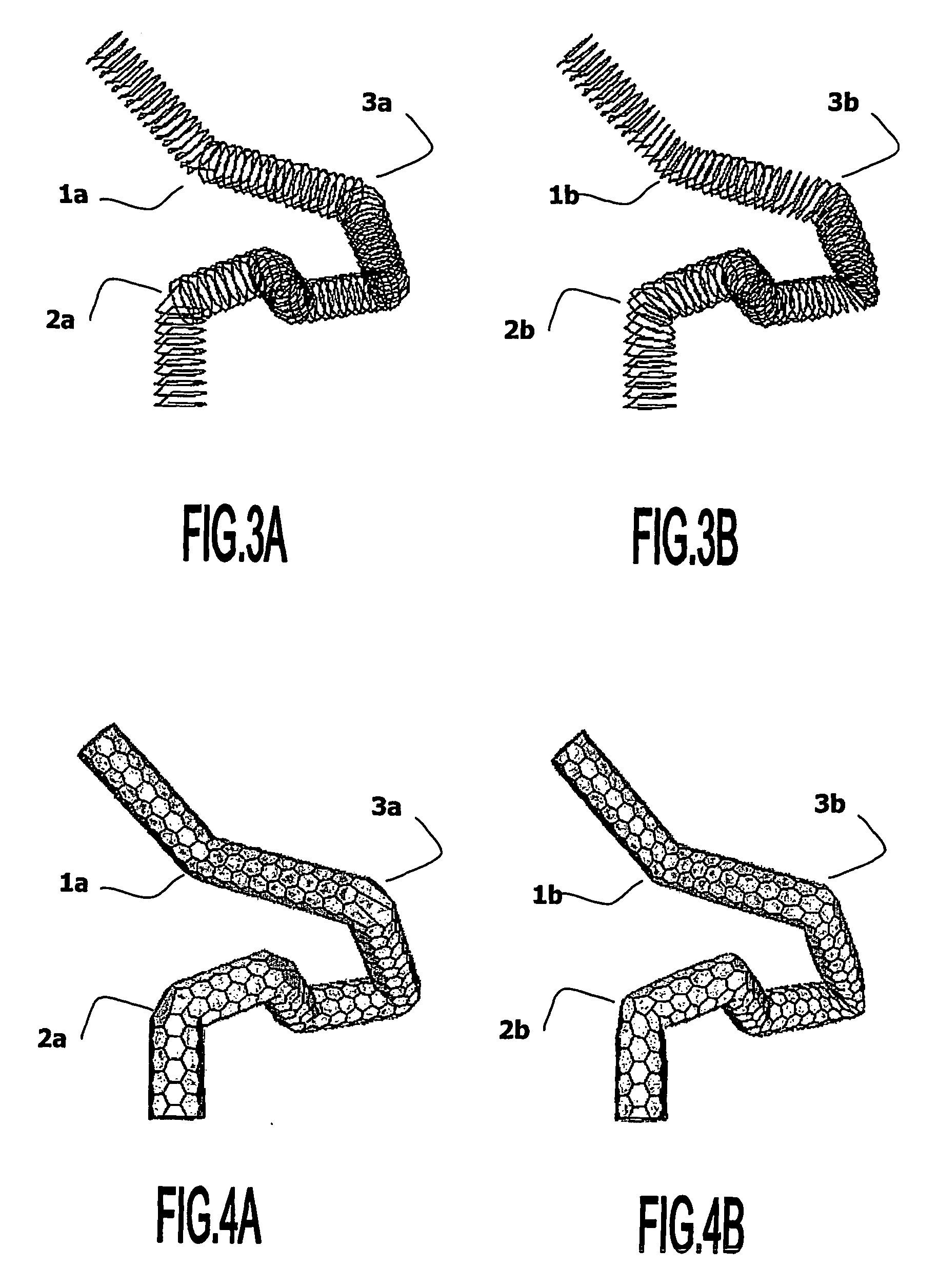 Image processing method for automatic adaptation of 3-d deformable model onto a substantially tubular surface of a 3-d object