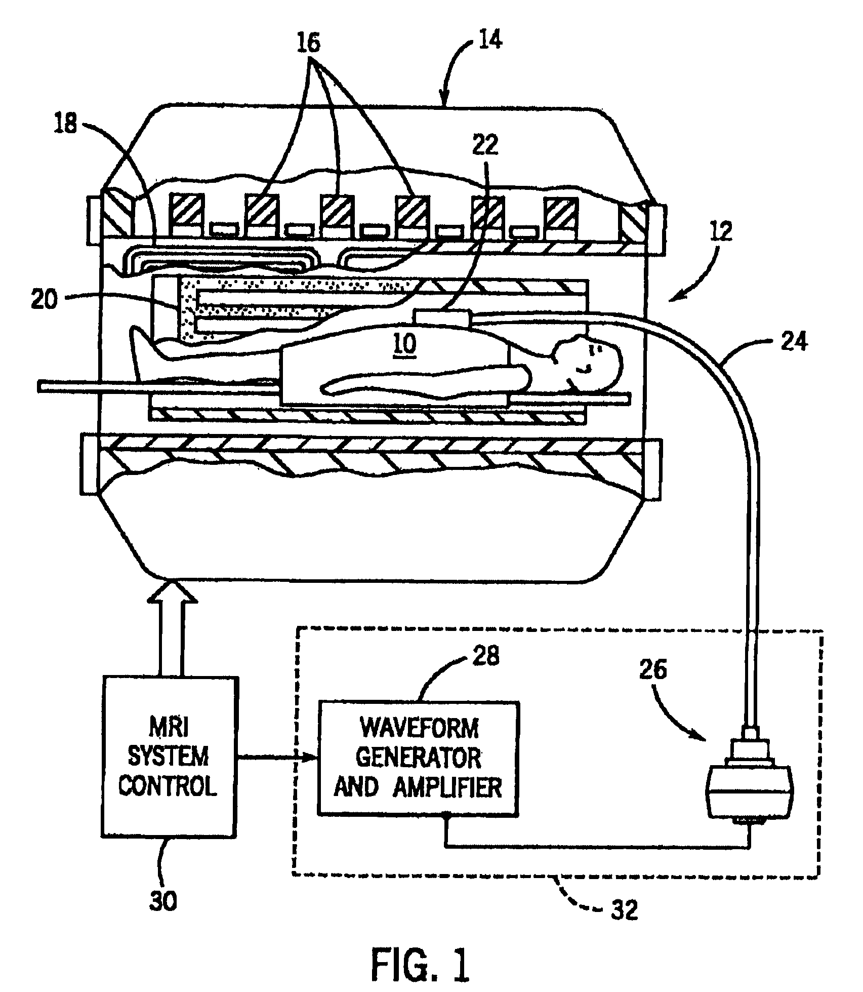 Flexible passive acoustic driver for magnetic resonance elastography