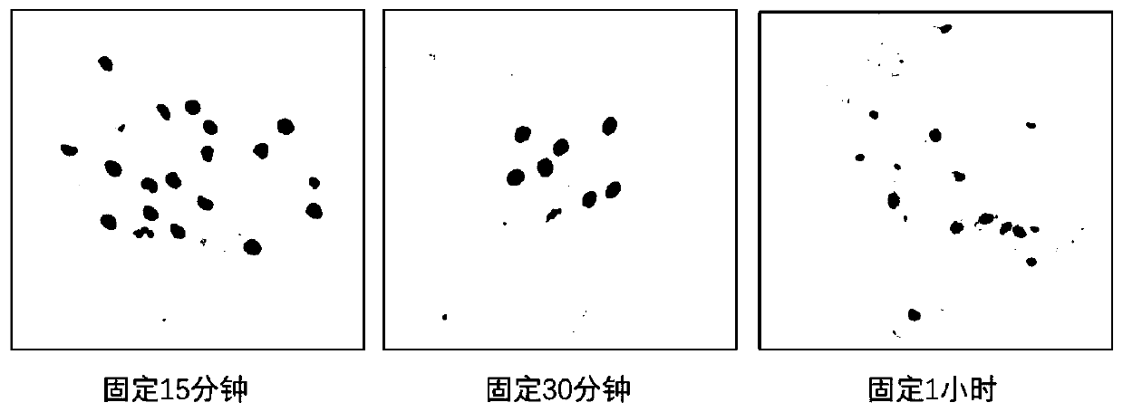 Human respiratory tract epithelial cell pathogen cytology detection method and kit