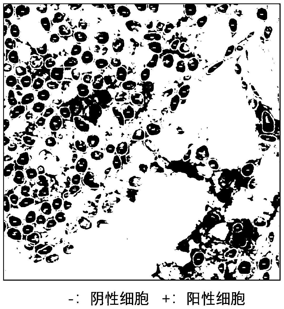 Human respiratory tract epithelial cell pathogen cytology detection method and kit