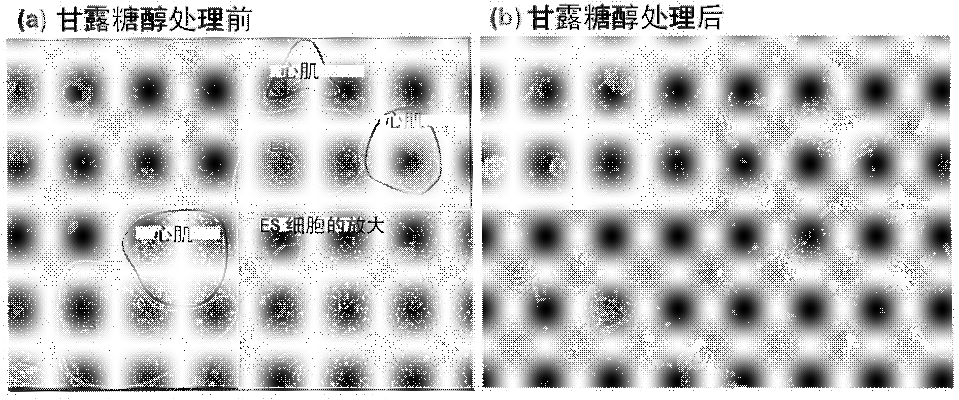 Method for inducing cell death in pluripotent stem cells and differentiated cells other than cardiac myocytes