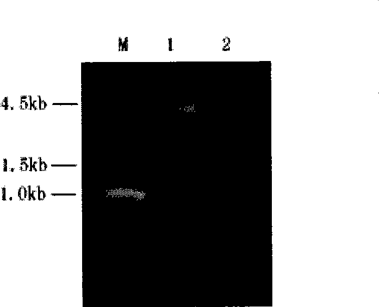 Method for preparing vaccine for anti-HPV 16 infection by pichia yeast expression system