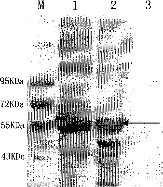 Method for preparing vaccine for anti-HPV 16 infection by pichia yeast expression system