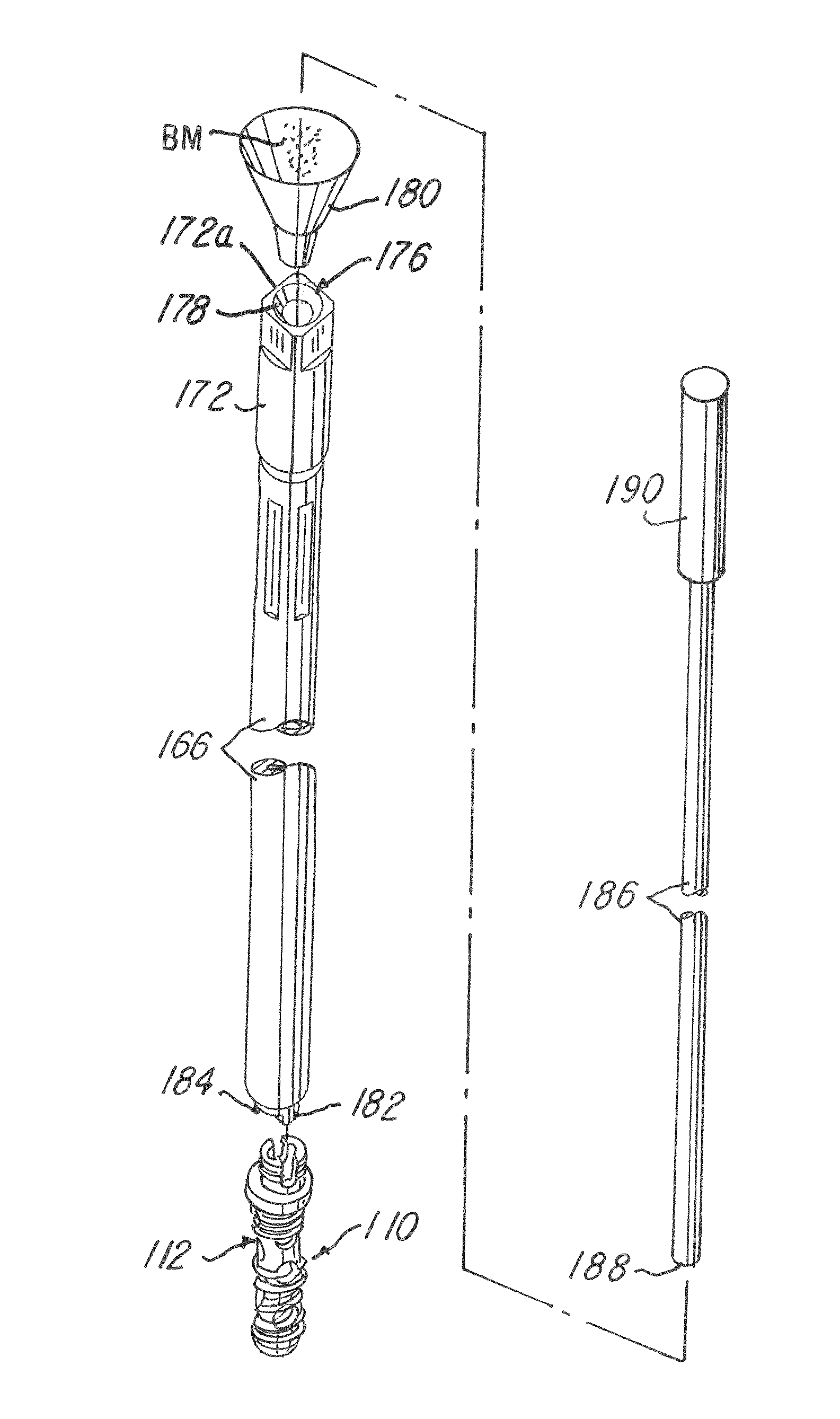 Minimally invasive spinal facet compression screw and system for bone joint fusion and fixation