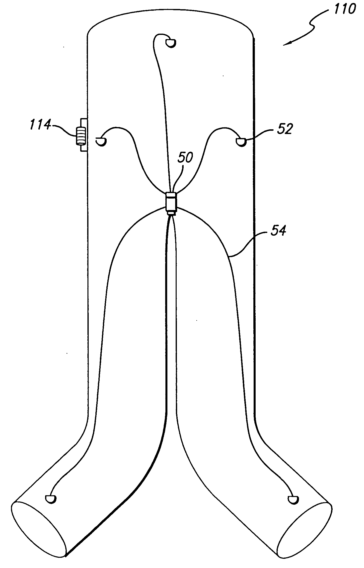 Endovascular graft with pressor and attachment methods