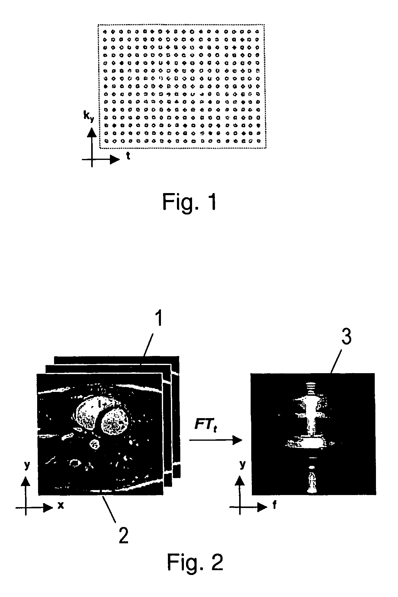 System and method of magnetic resonance imaging for producing successive magnetic resonance images