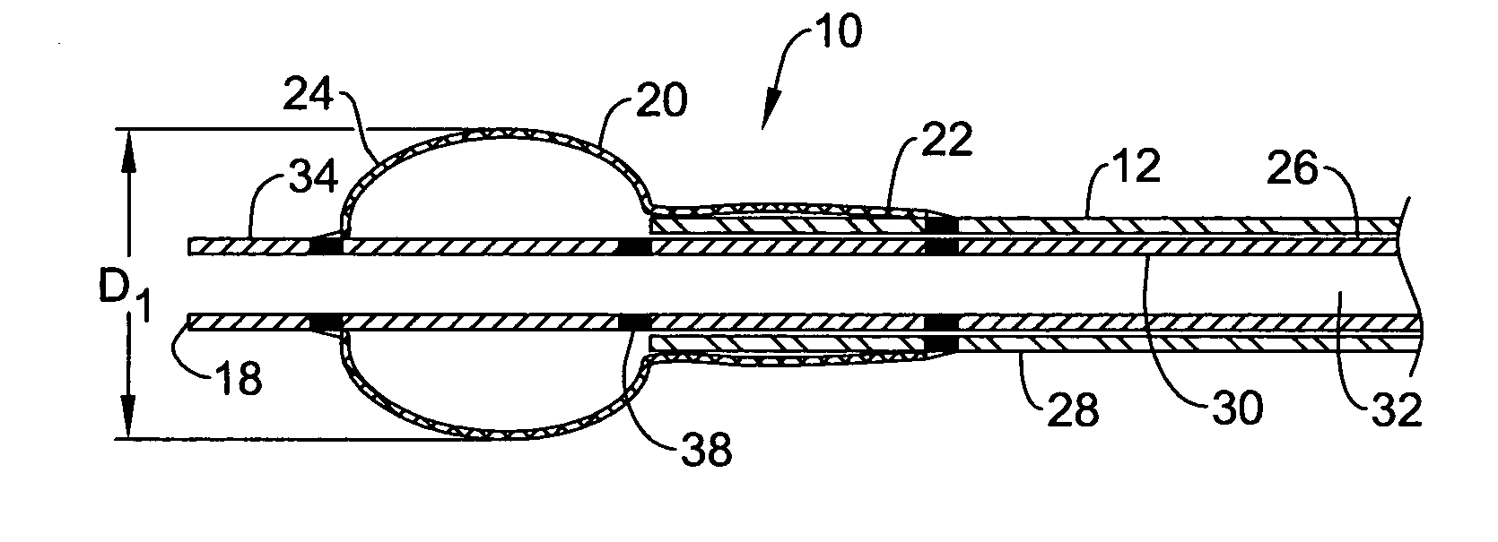 Occlusion balloon catheter with longitudinally expandable balloon