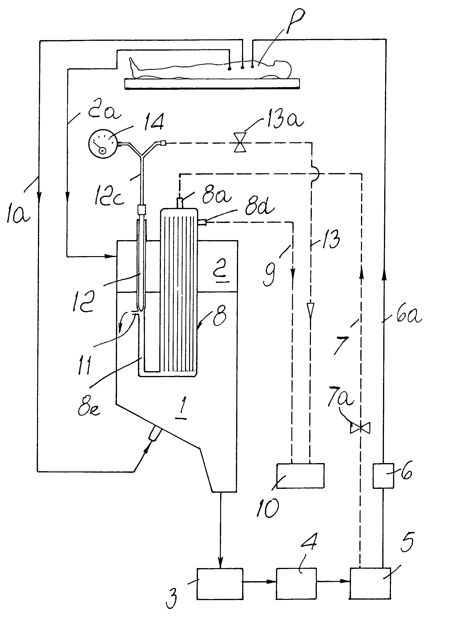 Hemoconcentrator in extracorporeal blood circuit