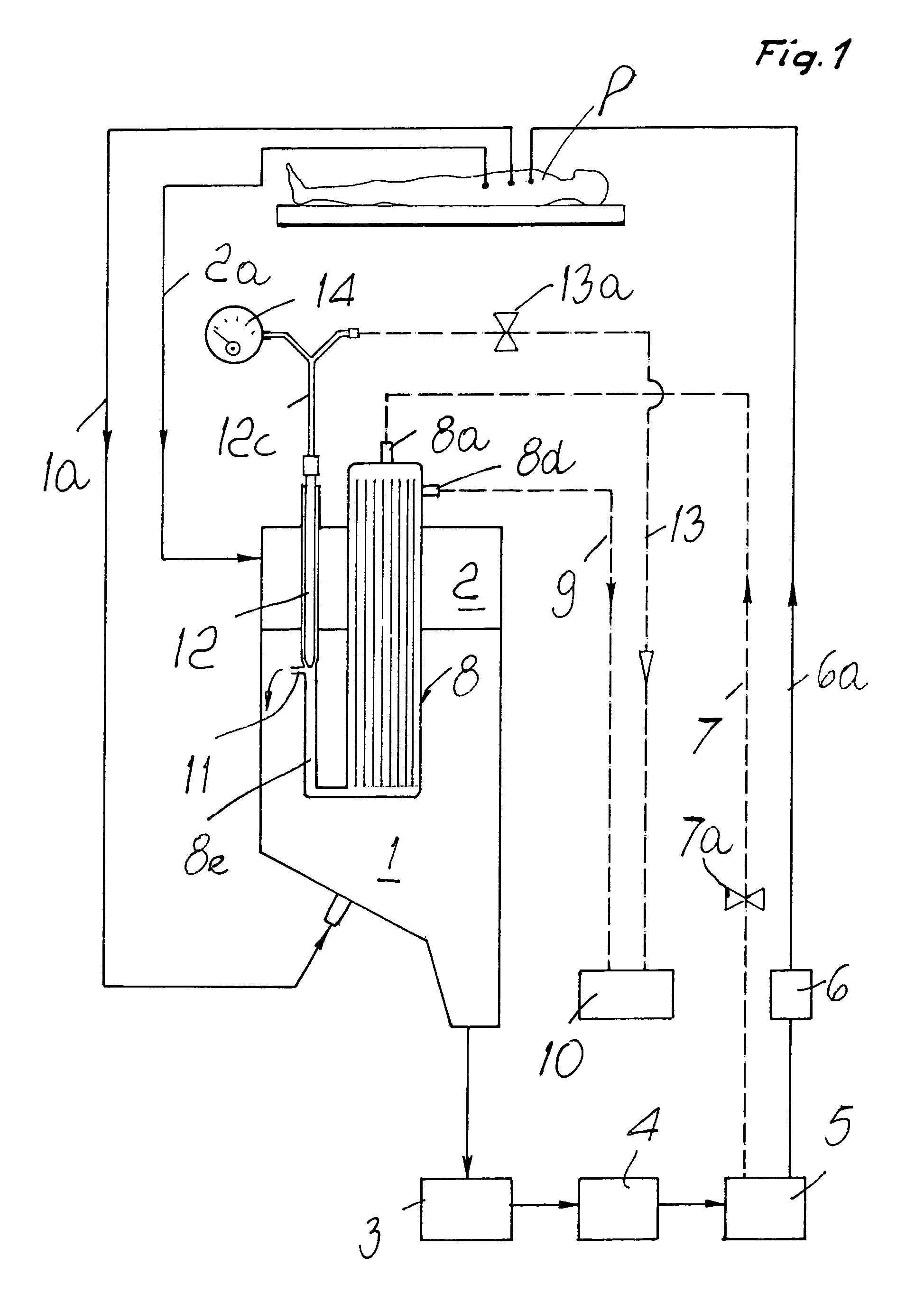 Hemoconcentrator in extracorporeal blood circuit