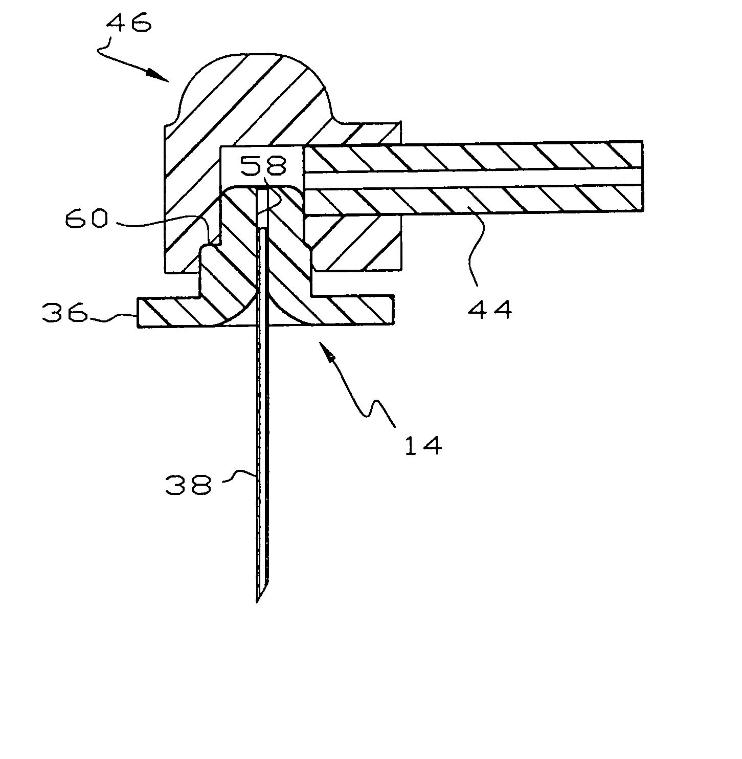 Method and apparatus for delivering dental anesthetic