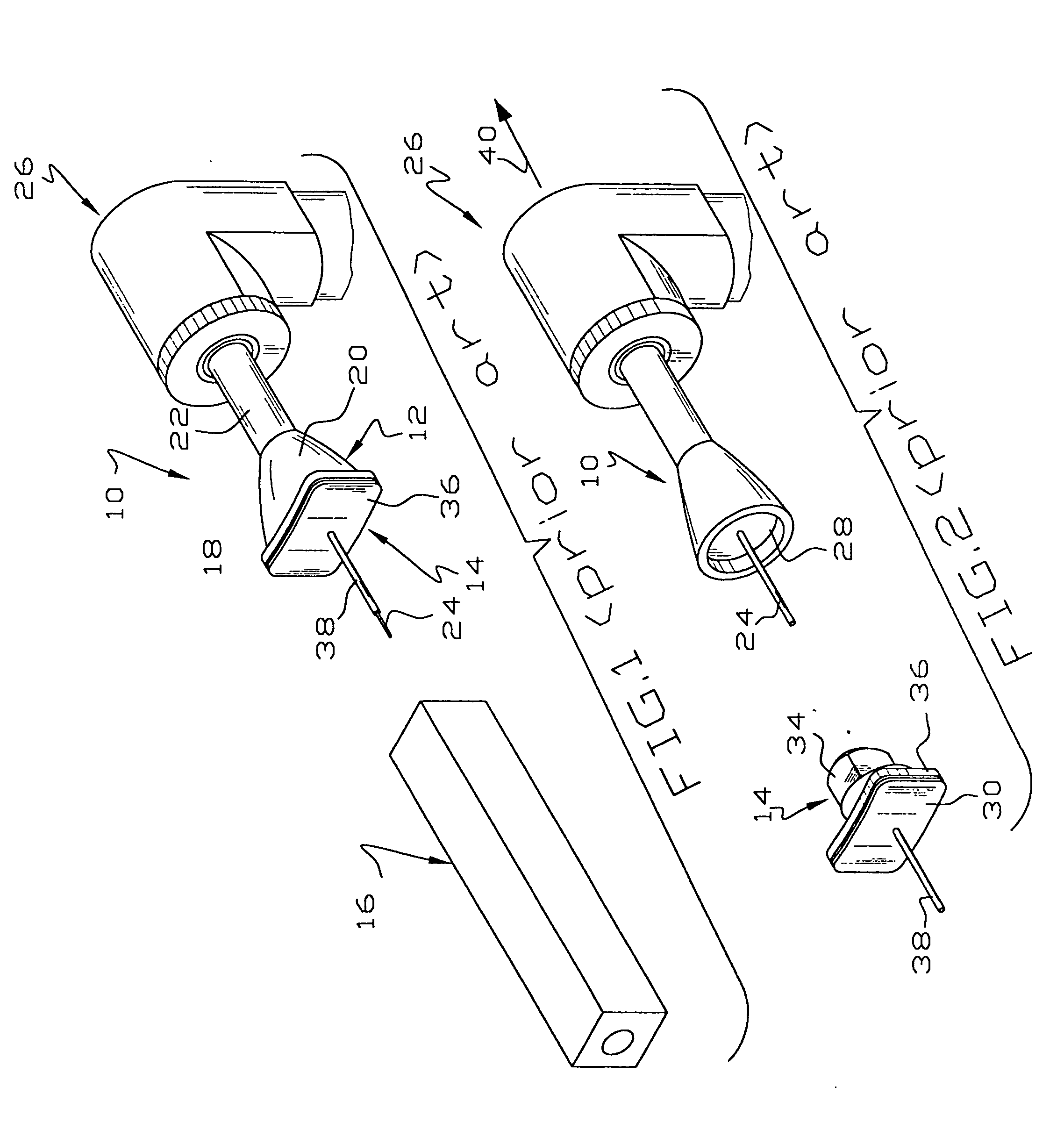 Method and apparatus for delivering dental anesthetic