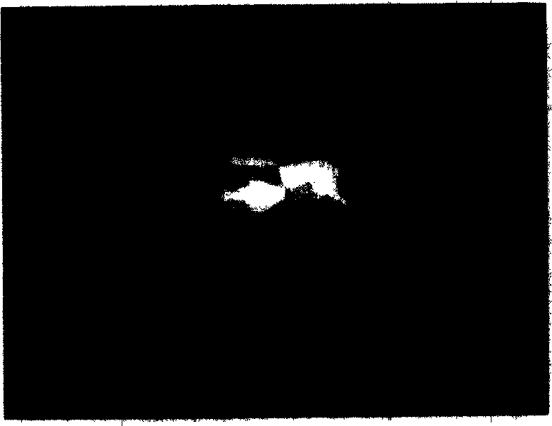 Composite material for repairing deletion of tooth and human hard tissues and its preparation