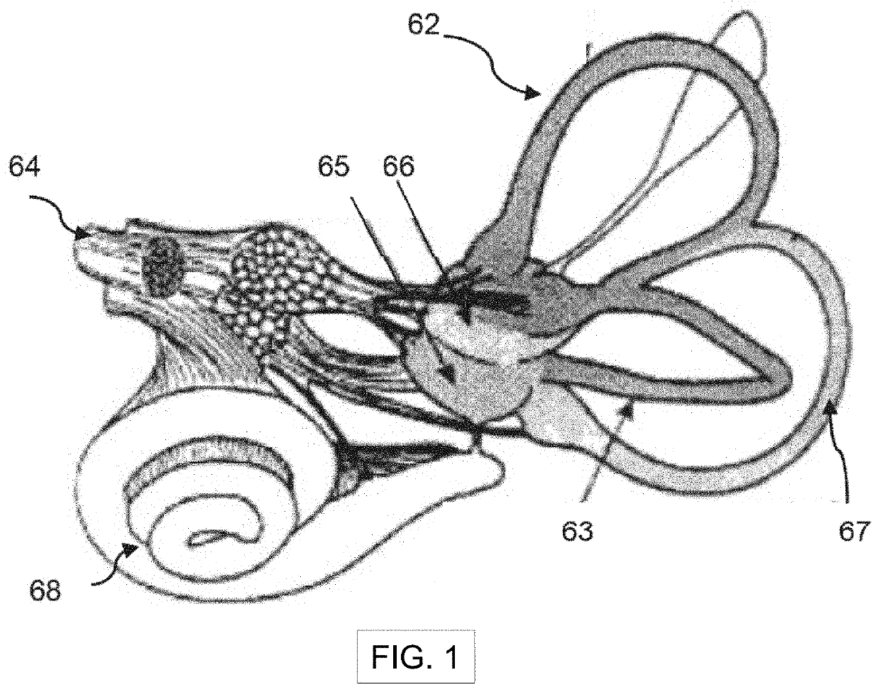 Systems, devices and methods for sleep therapy using vestibular nerve stimulation