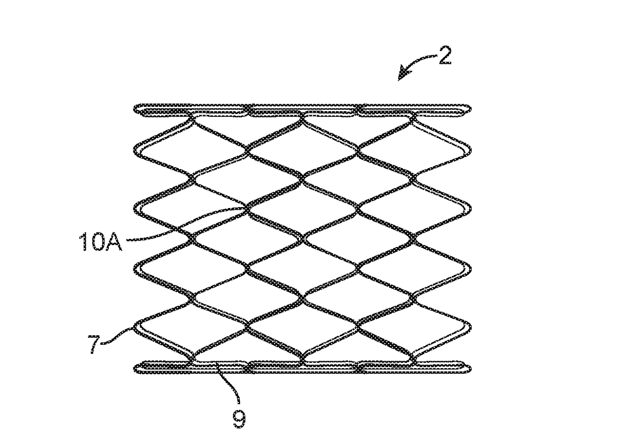 Vascular implants and methods