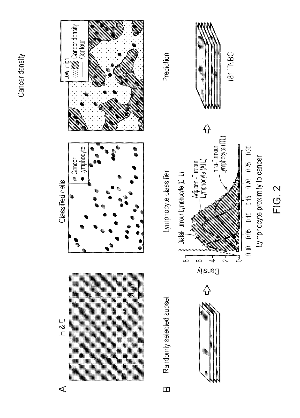 Scoring of tumor infiltration by lymphocytes