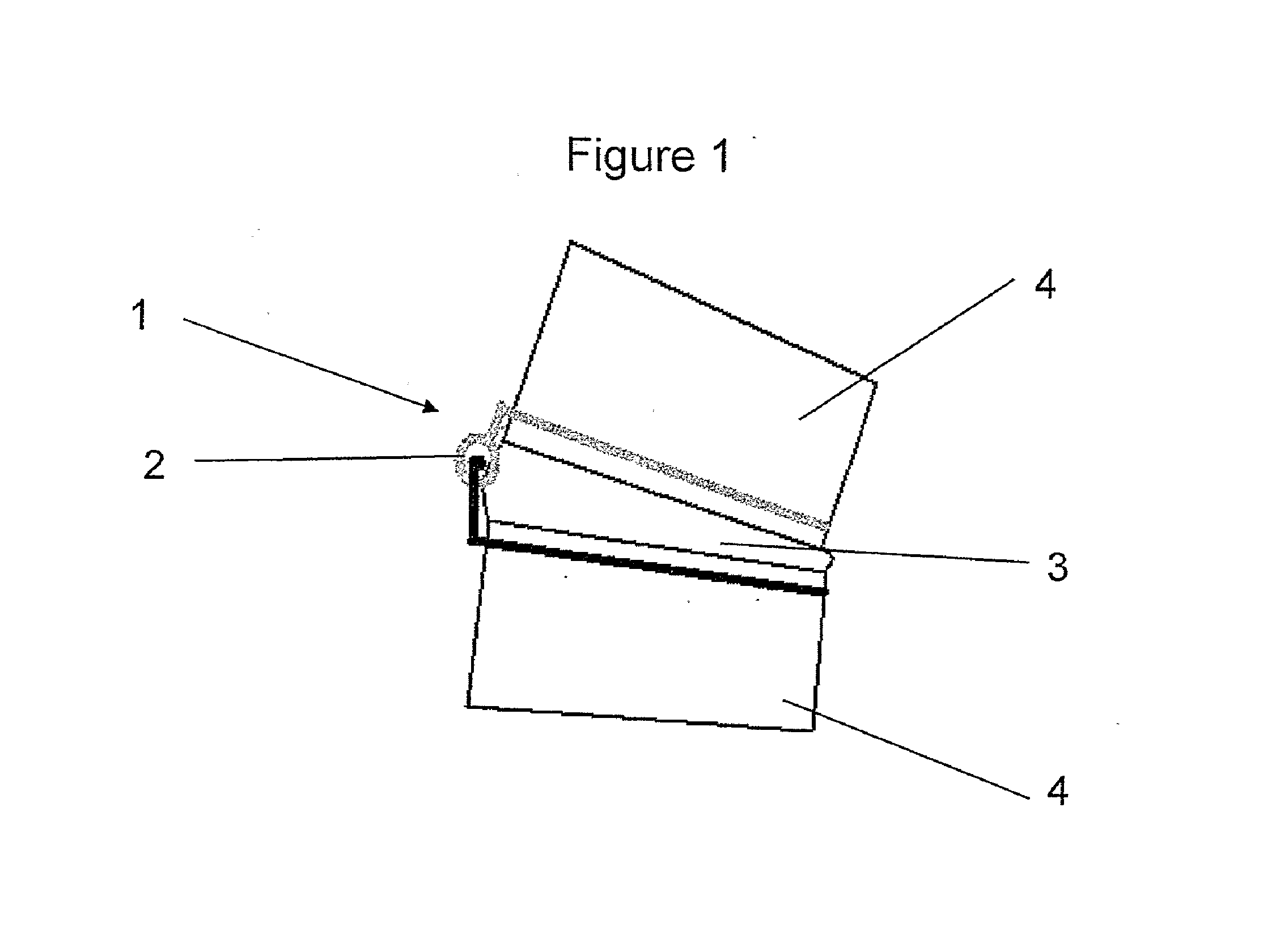 Implantable apparatus for modulation of skeletal growth