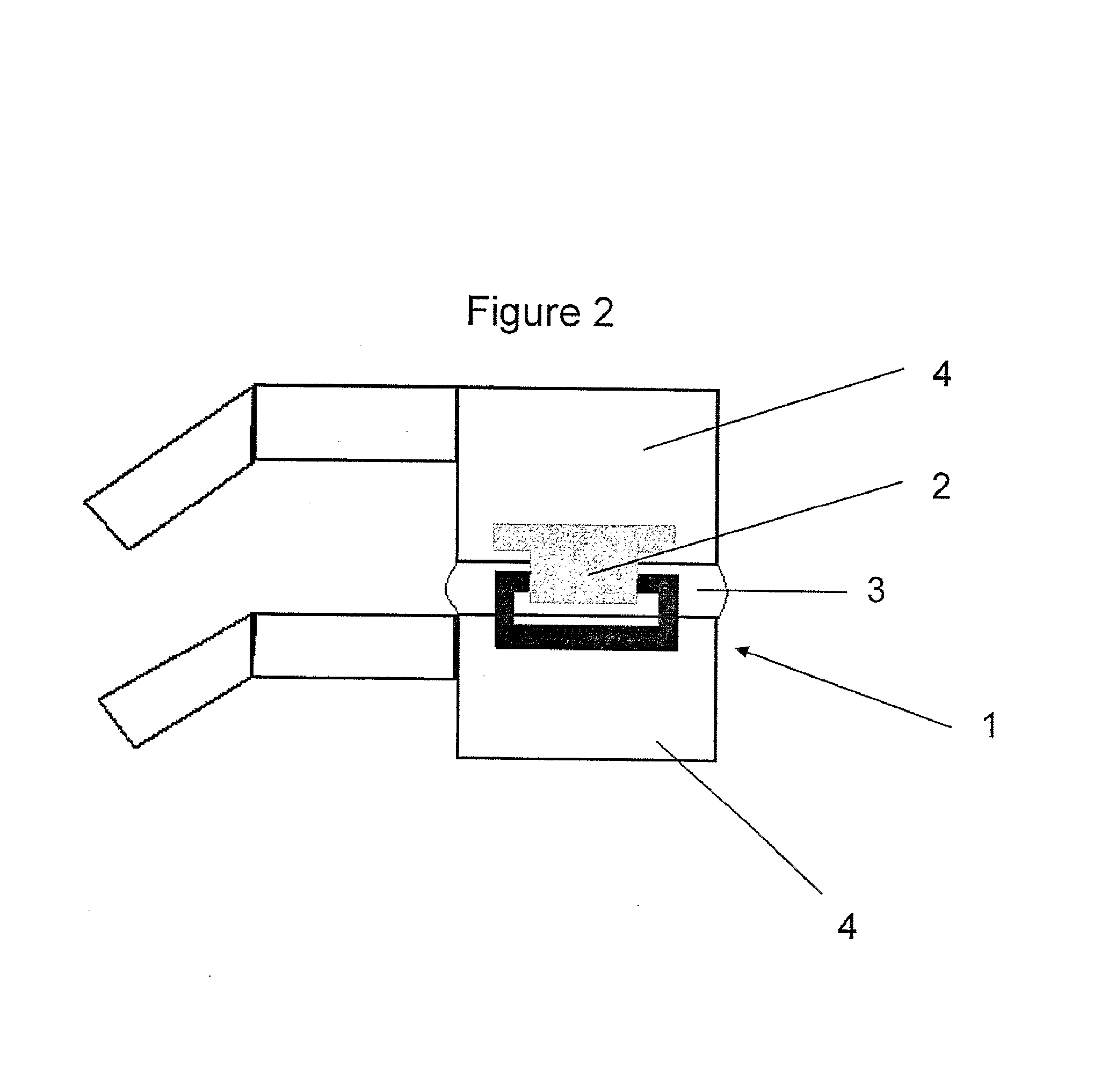 Implantable apparatus for modulation of skeletal growth