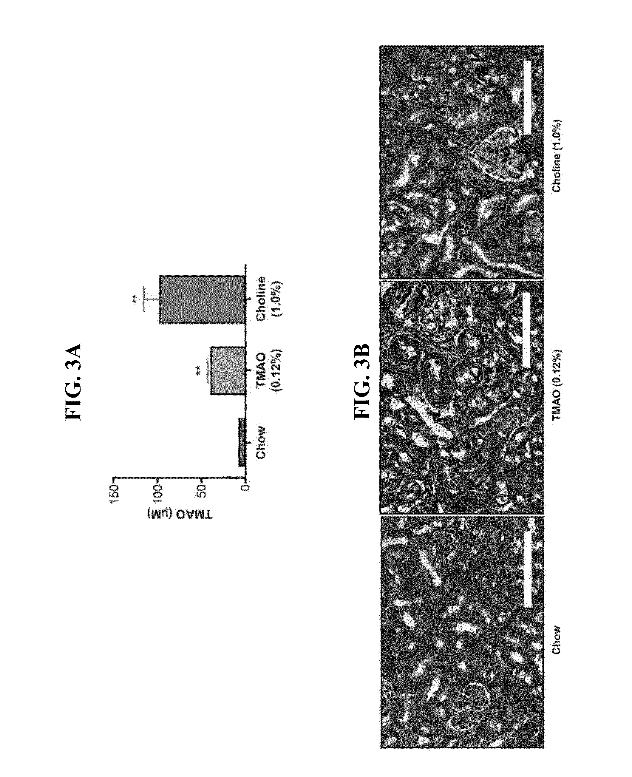 Treating and preventing disease with tma and tmao lowering agents