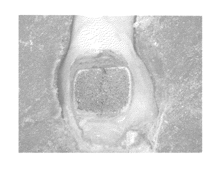 Methods of identifying orthodontic adhesives