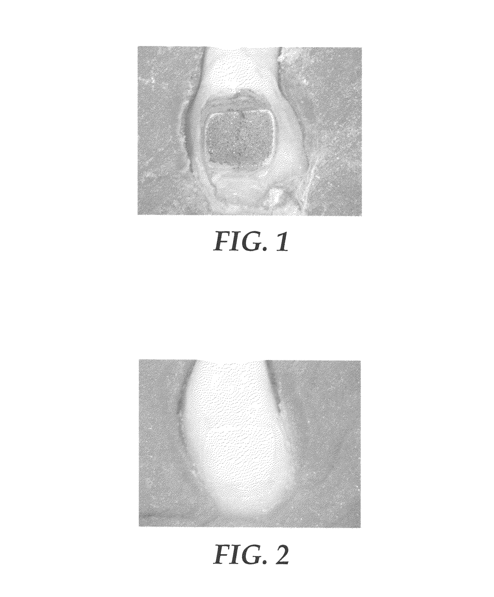 Methods of identifying orthodontic adhesives