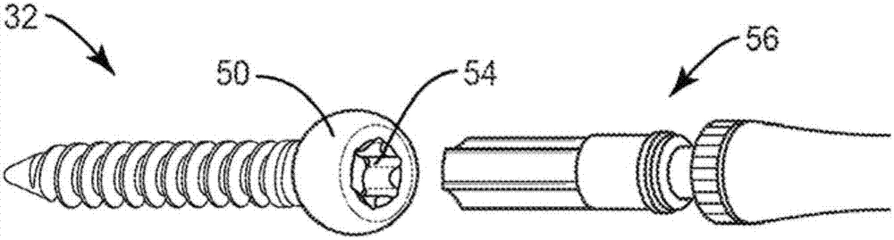 Spinal implant system and method of use