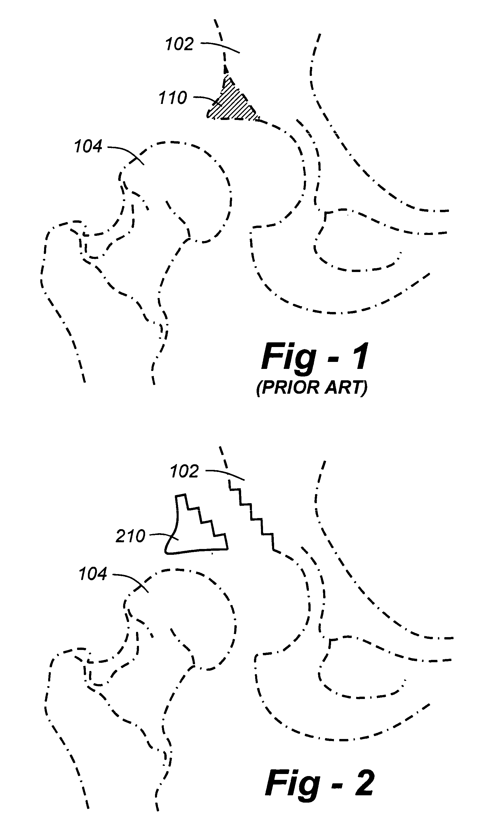 Geometric replacements for defective bone