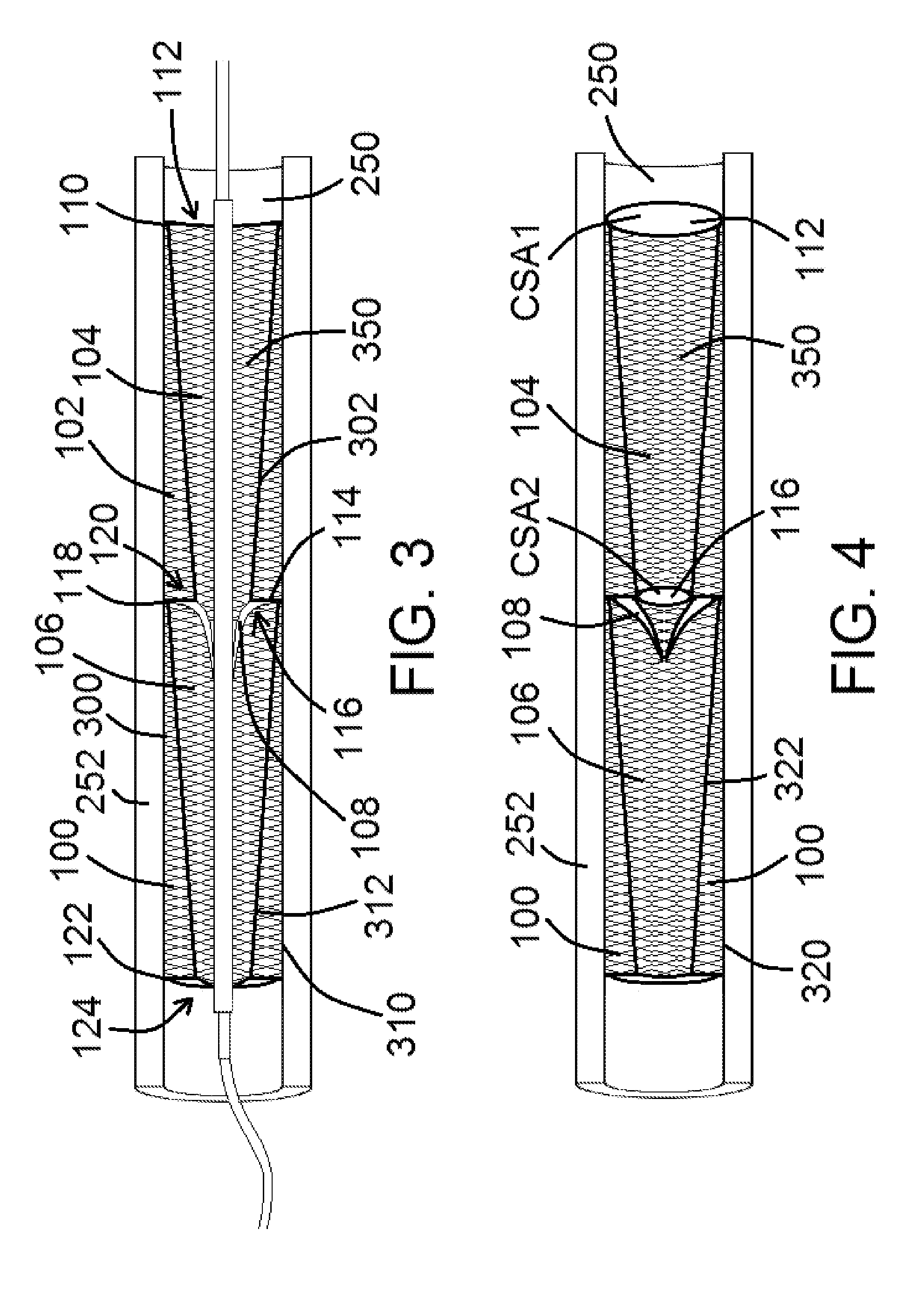 Devices and methods for assisting valve function, replacing venous valves, and predicting valve treatment success