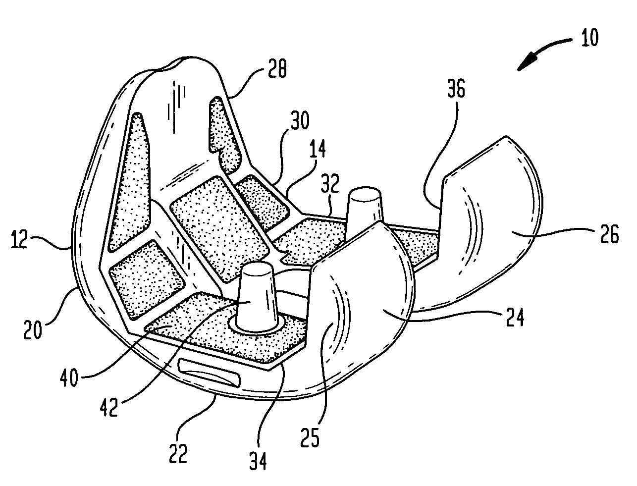 Laser-produced implants