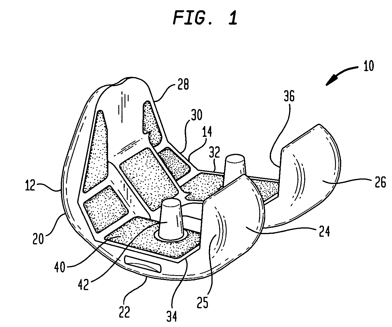 Laser-produced implants