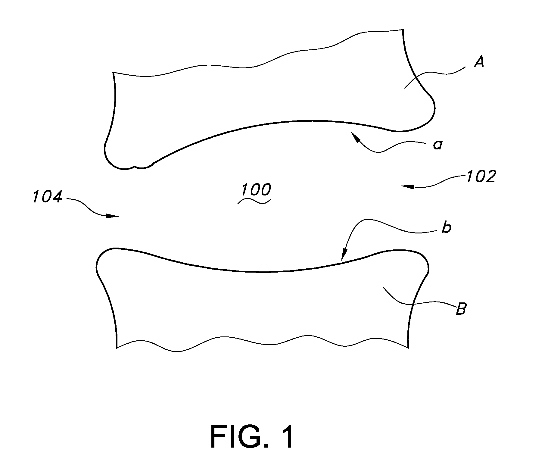 Reverse cage intervertebral fusion implants