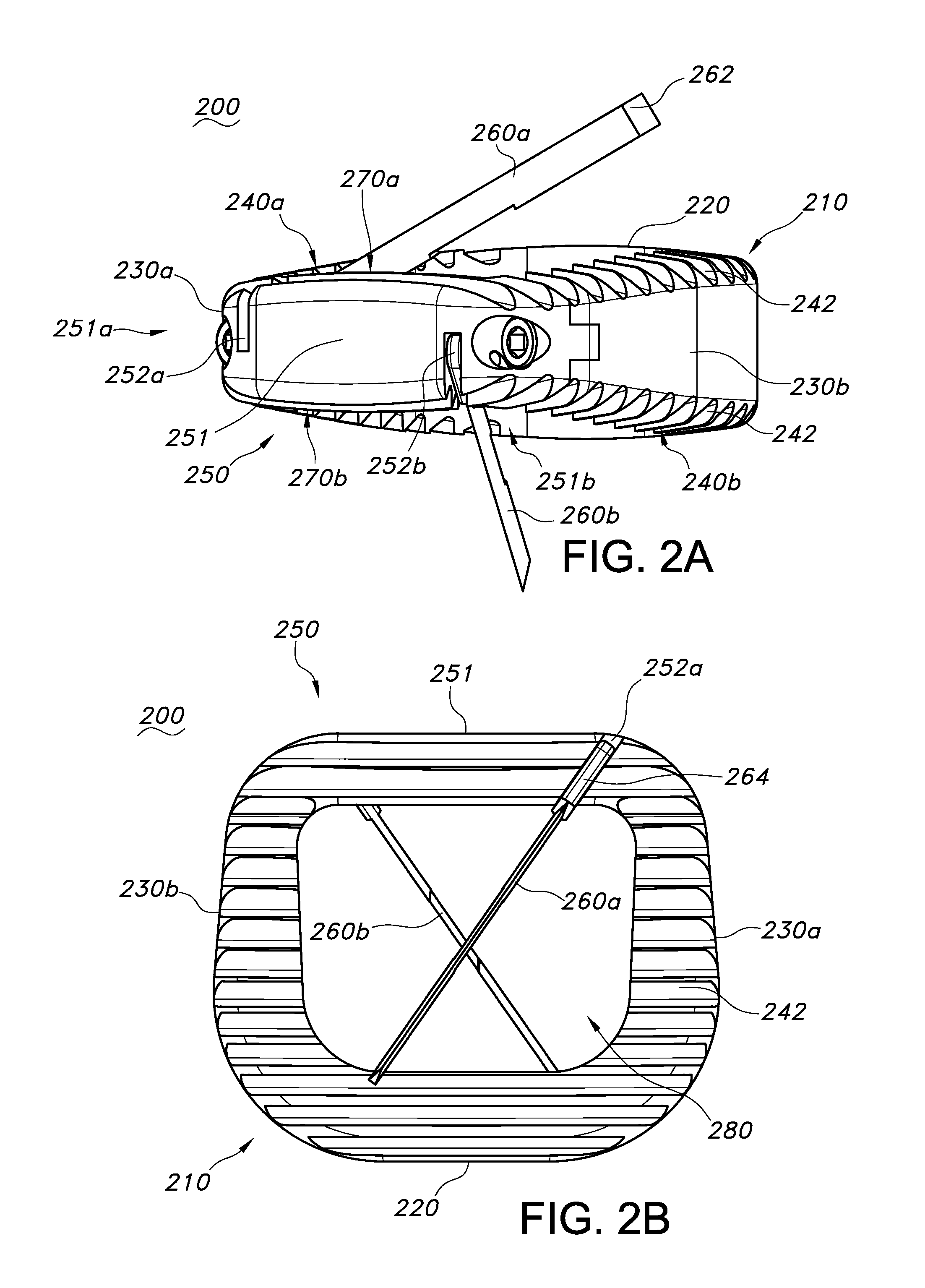 Reverse cage intervertebral fusion implants