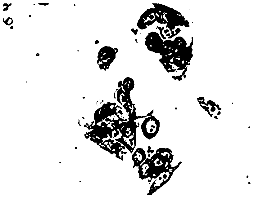 A magnetic resonance imaging contrast agent and its preparation method and application