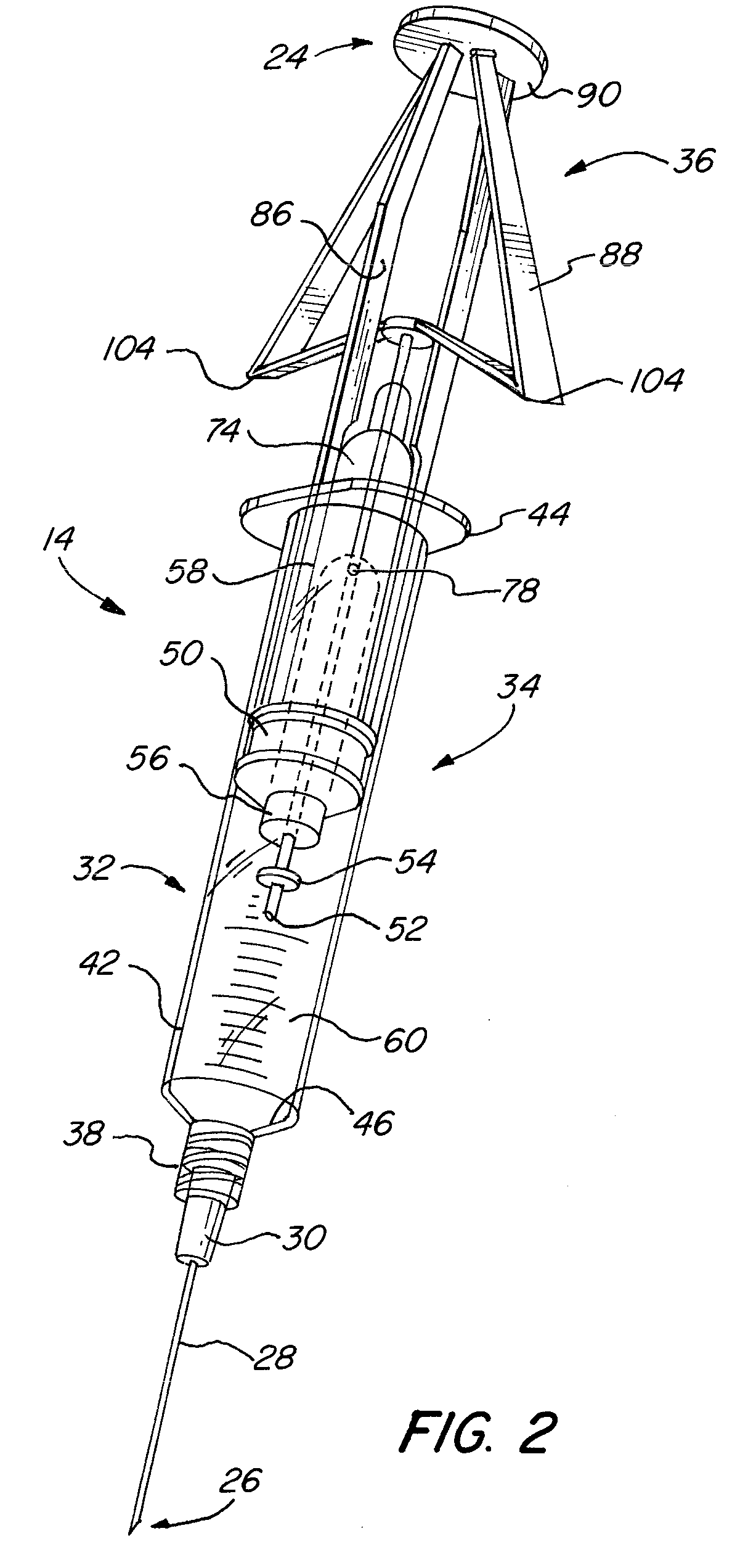 Steroid Delivery System