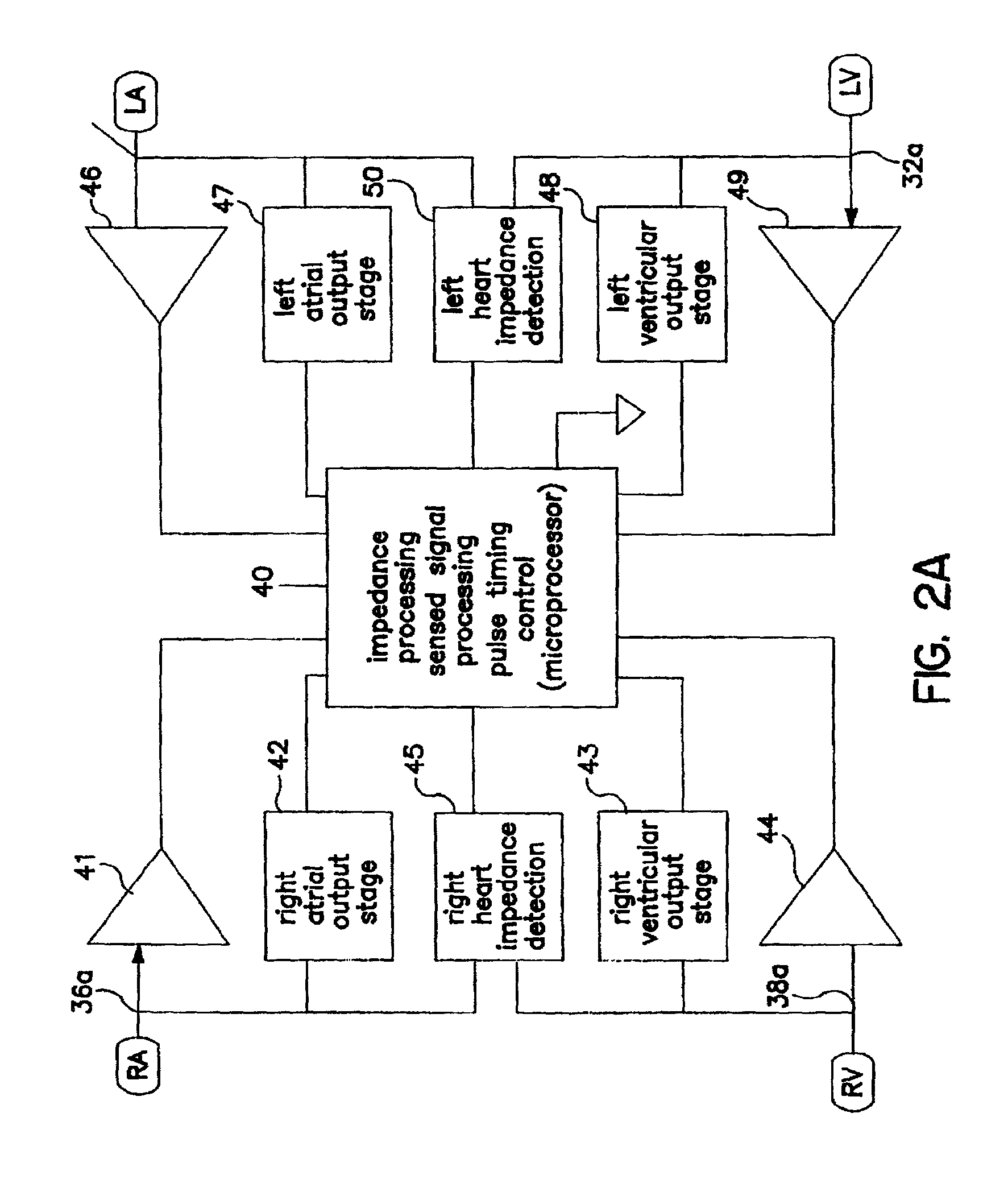 Algorithm for the automatic determination of optimal AV and VV intervals