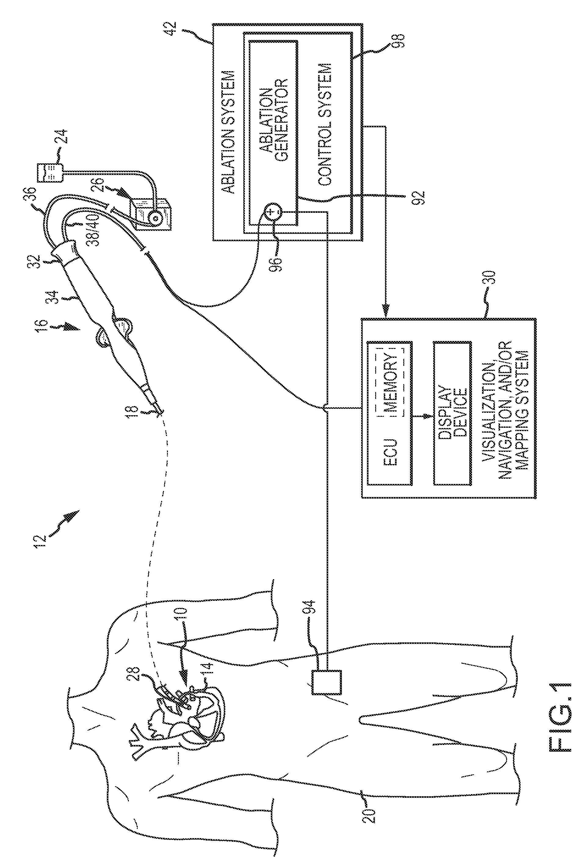 Irrigant distribution system for electrodes