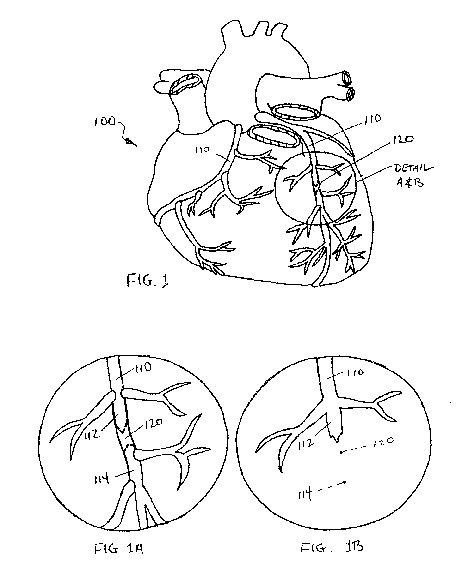 Methods of accessing an intramural space