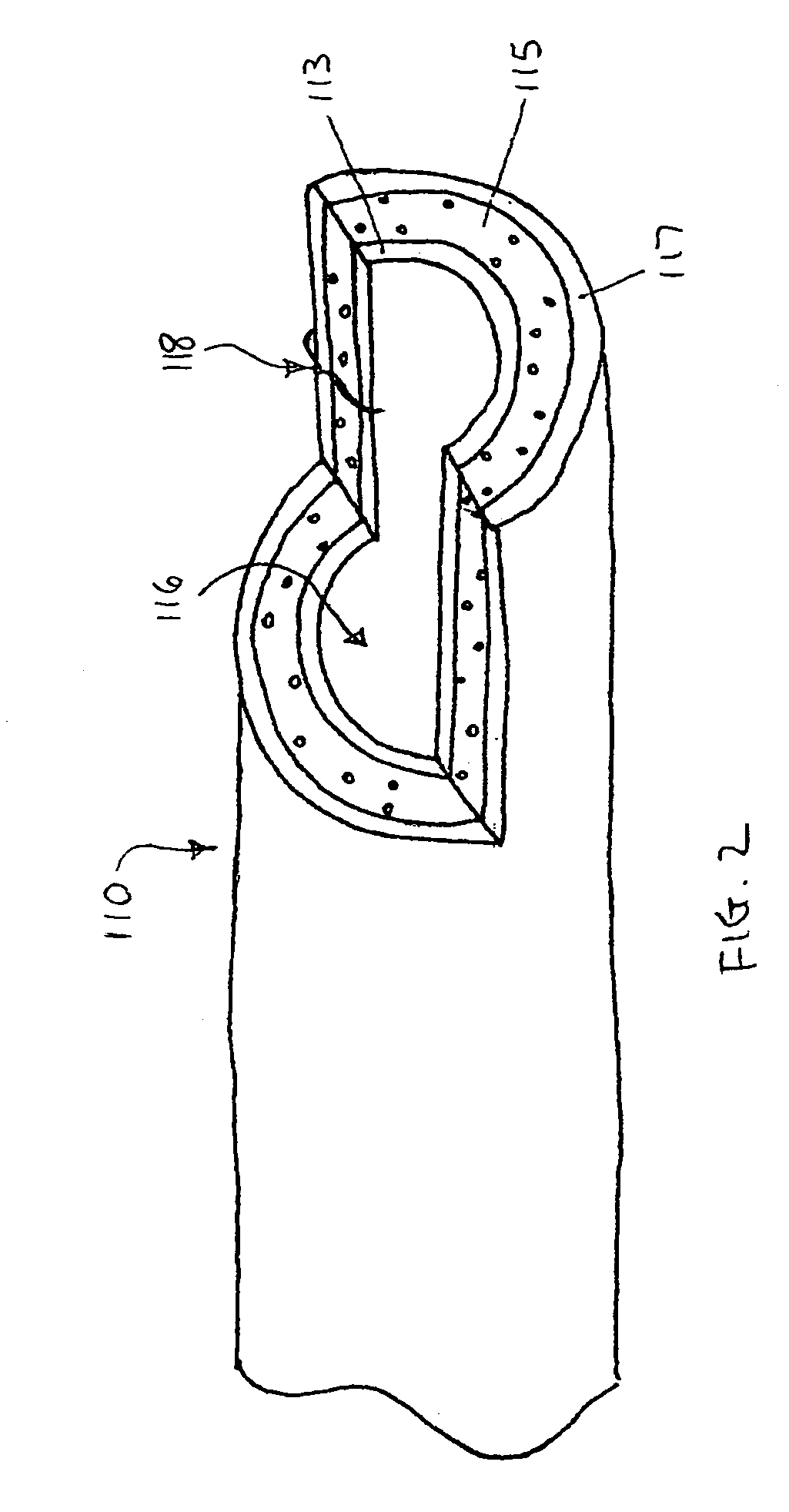 Methods of accessing an intramural space