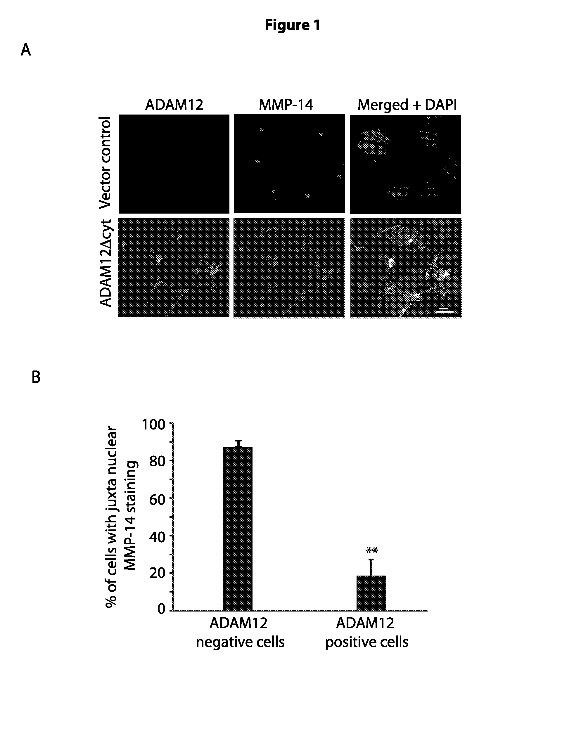 Anti-ADAM12 antibodies for the treatment of cancer