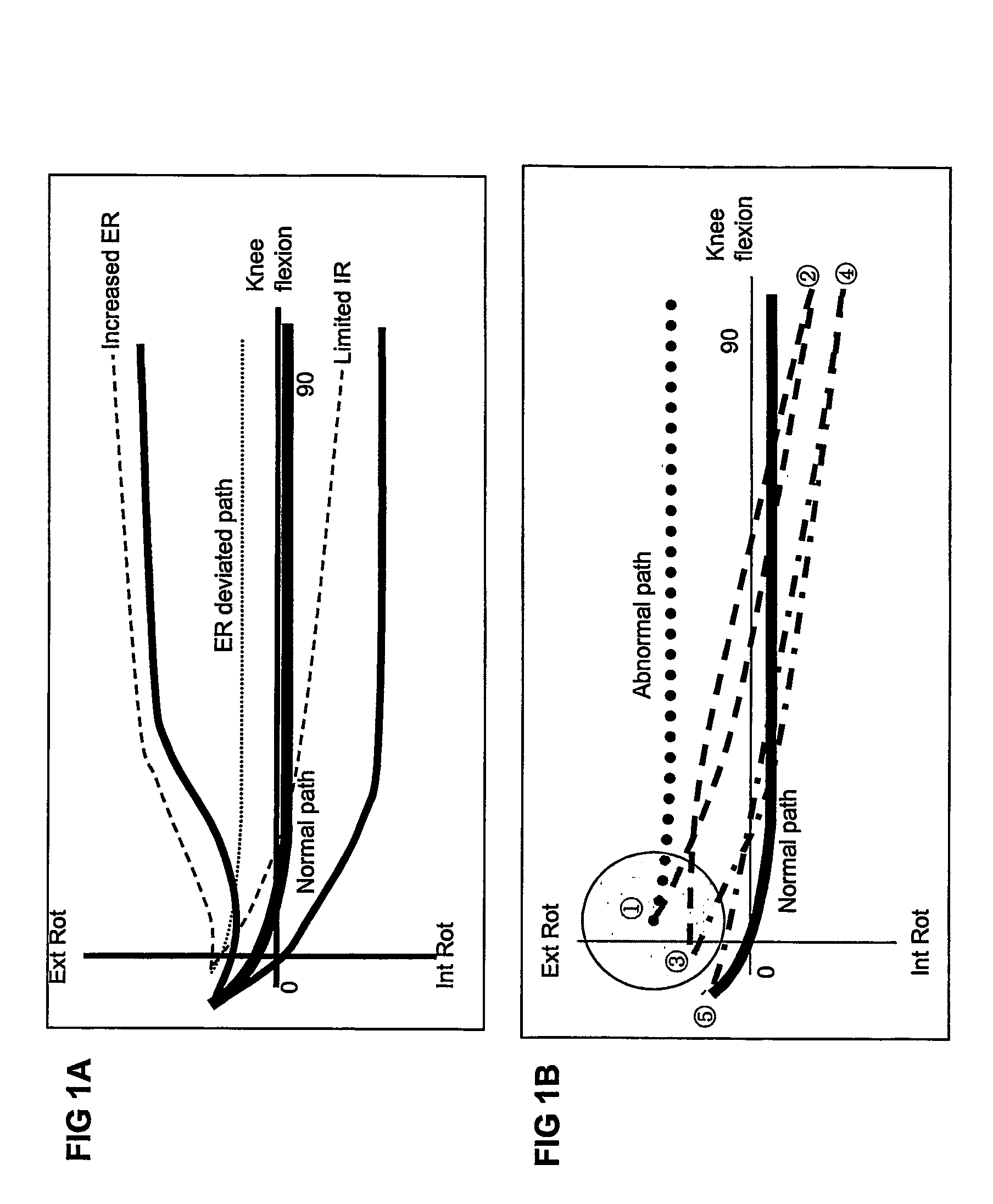 Non-surgical correcting abnormal knee loading