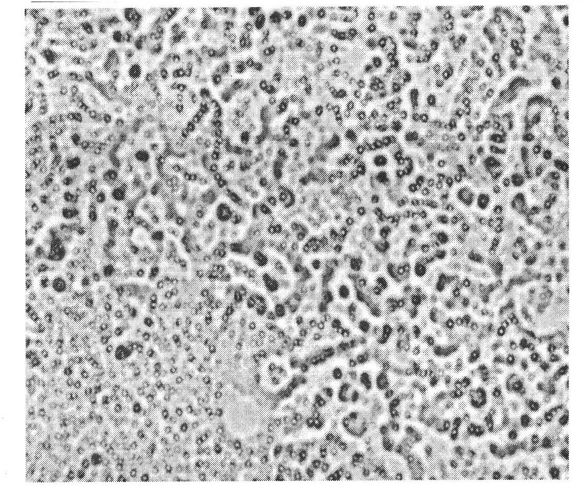 Veterinary danofloxacin mesylate slow-release microsphere preparation as well as preparation method and application of veterinary danofloxacin mesylate slow-release microsphere preparation