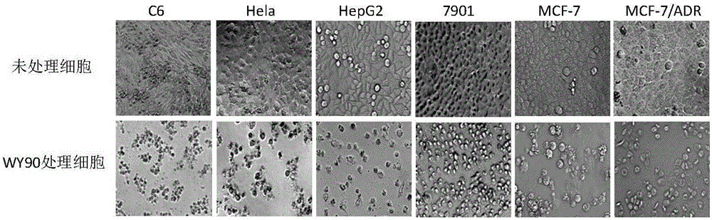 Application of aromatic ester compounds in preparing anti-tumor drugs