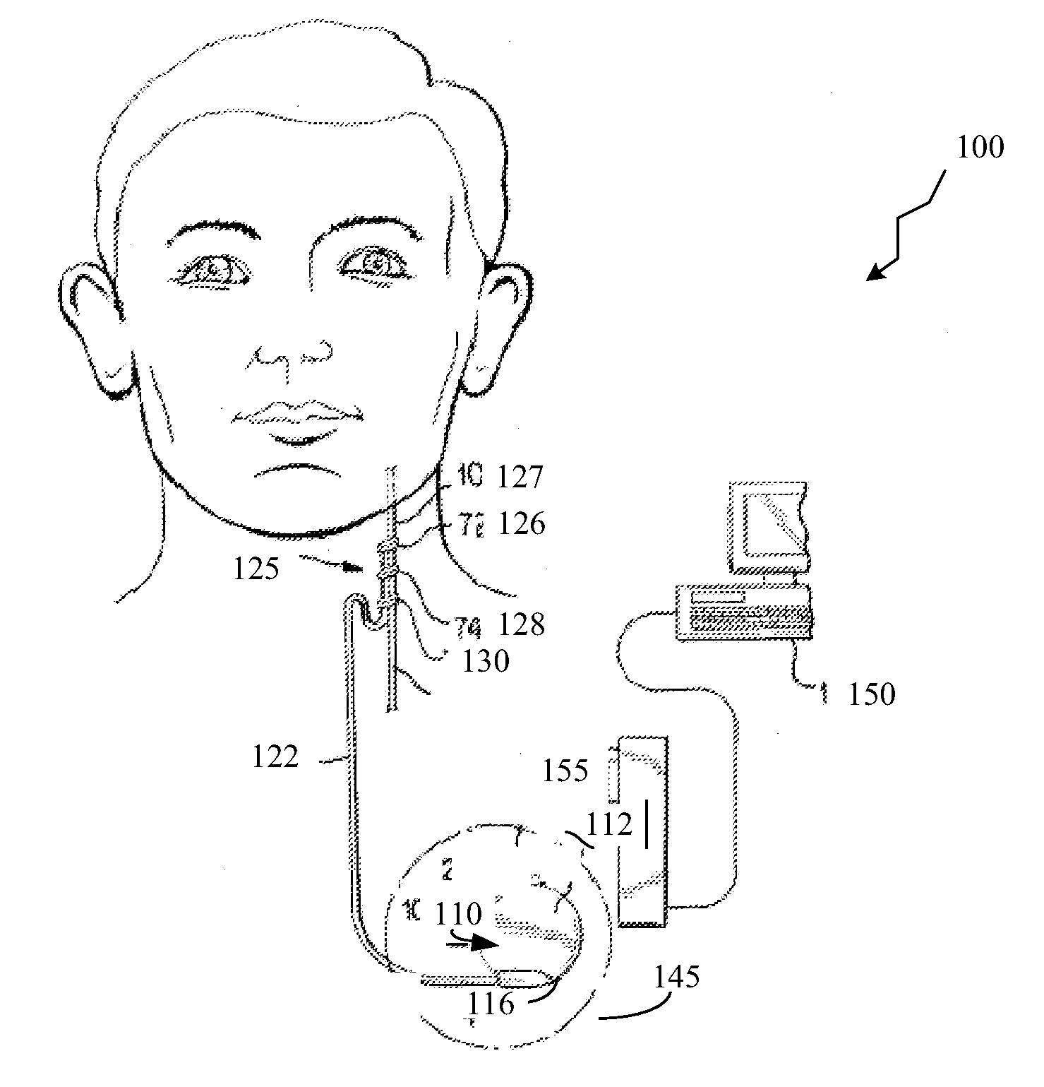 Method, apparatus and system for validating and quantifying cardiac beat data quality