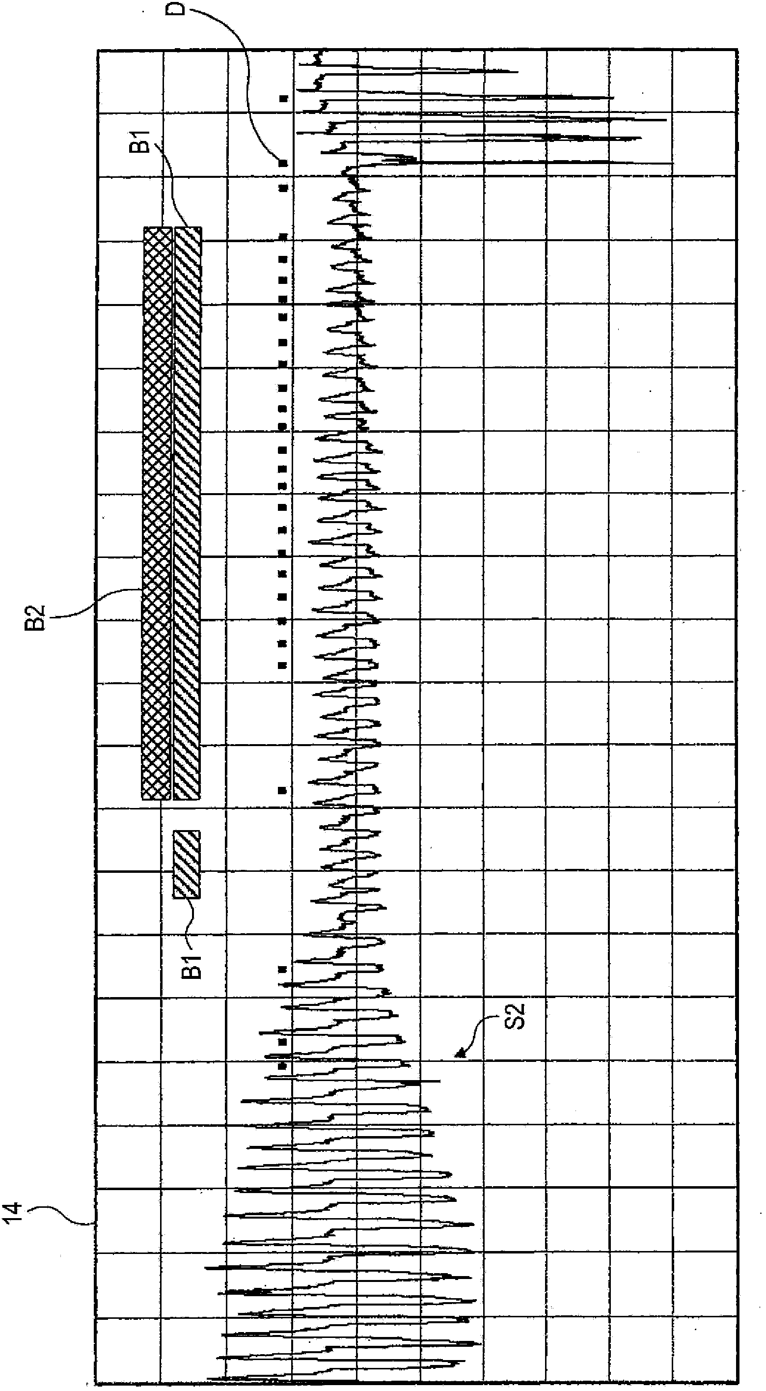 Apparatus for determining respiratory condition