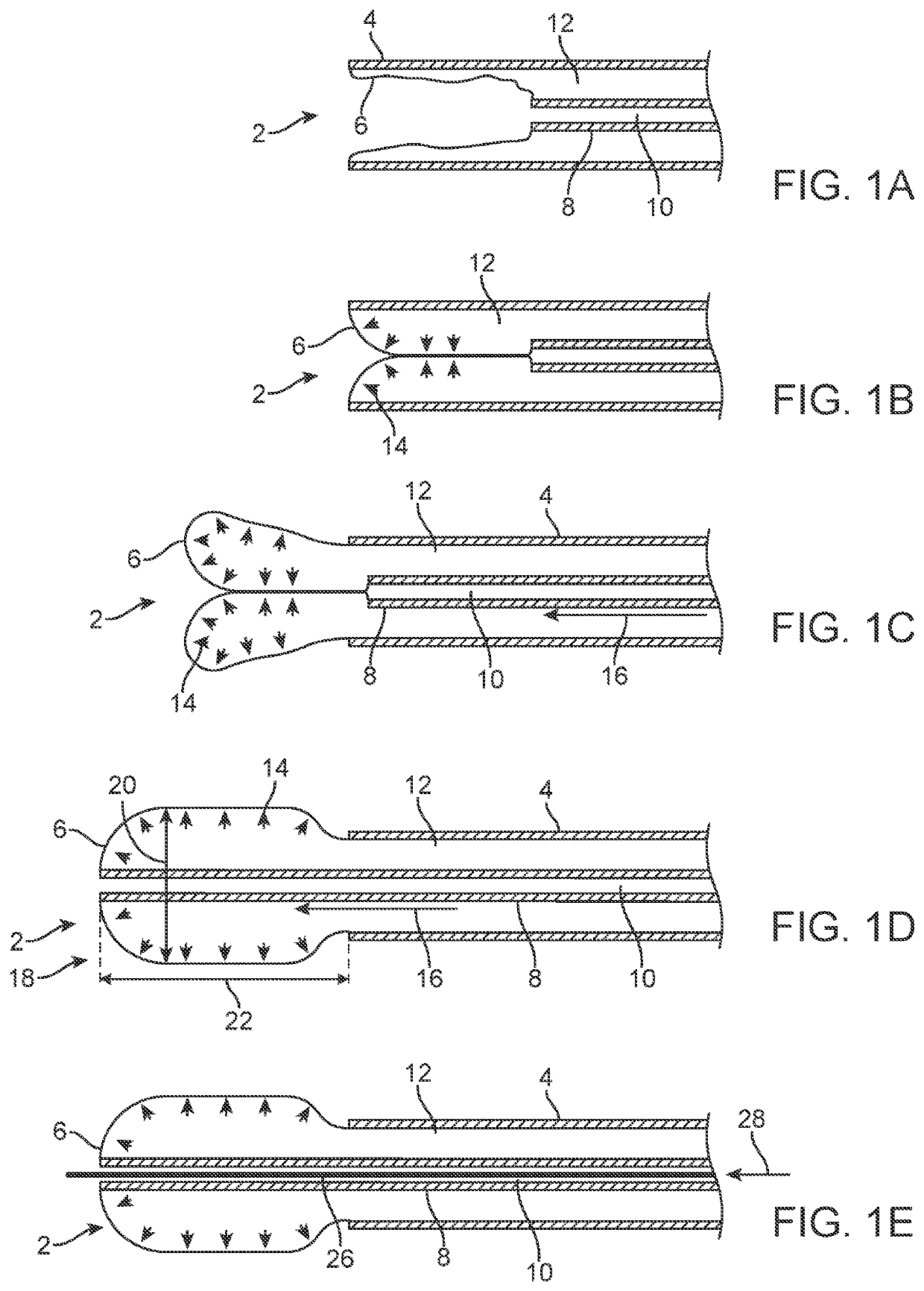 Apparatus and method for everting catheter for iud delivery and placement in the uterine cavity