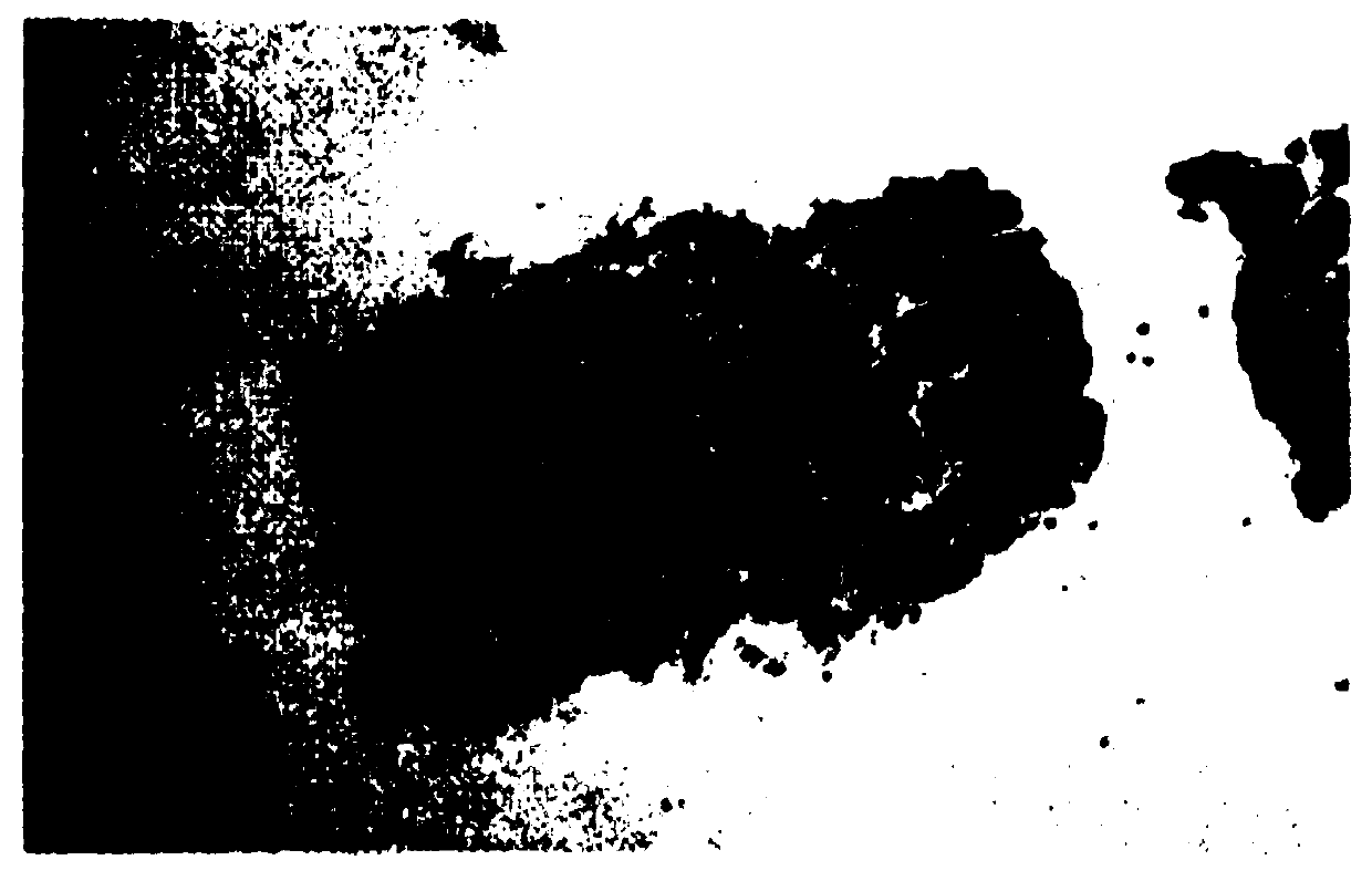 Laser microporous acellular dermal matrix and preparation method thereof